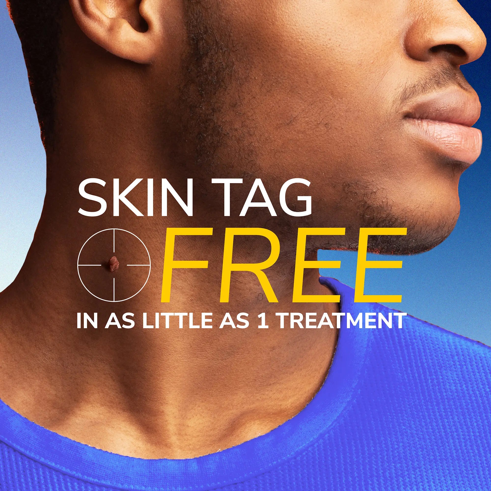 Freeze Away Skin Tag Remover - Image 3