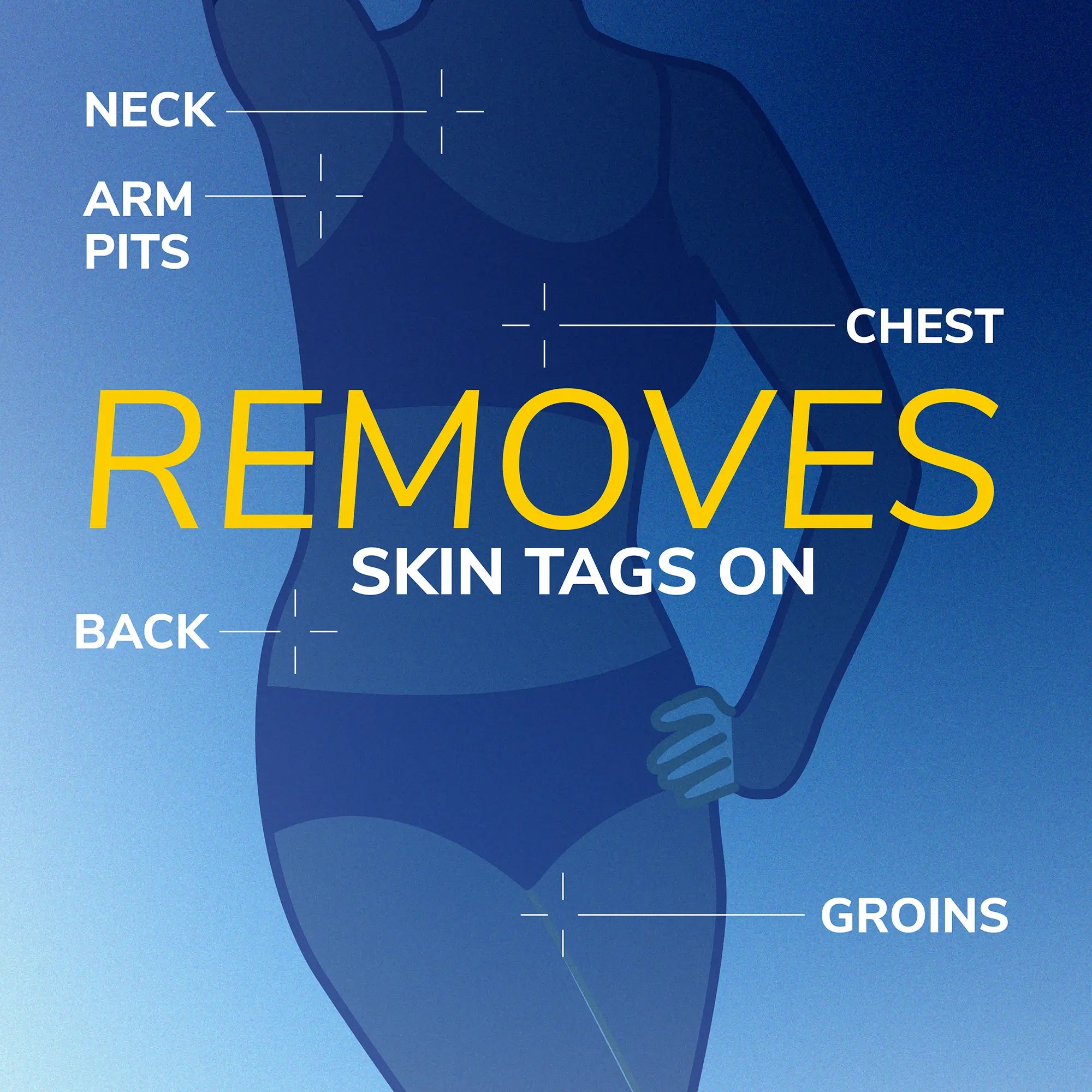 Freeze Away Skin Tag Remover - Image 7